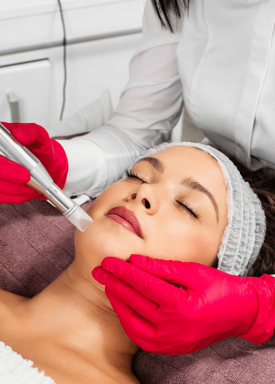 Microneedling Treatment | Exhibit Medical Aesthetics in Denville, NJ