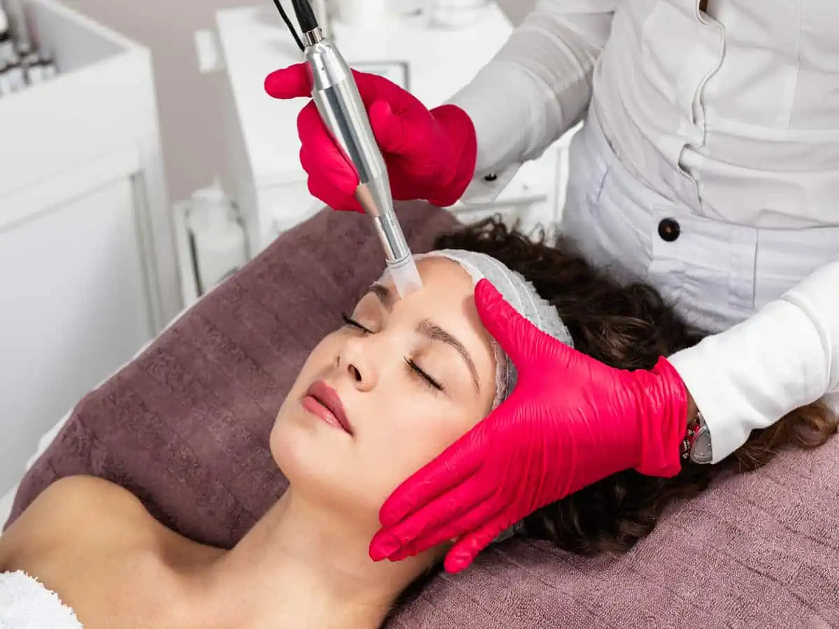 microneedling by exhibit medical aesthetics in Denville, NJ