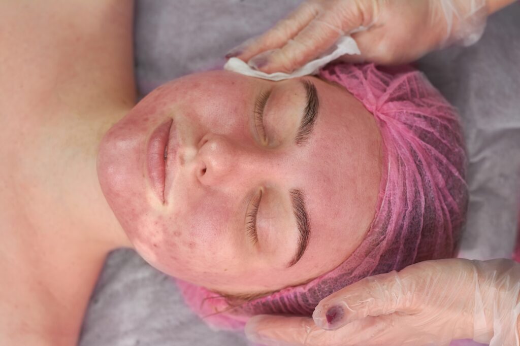 Hands of cosmetician, female face. Girl with problematic skin.