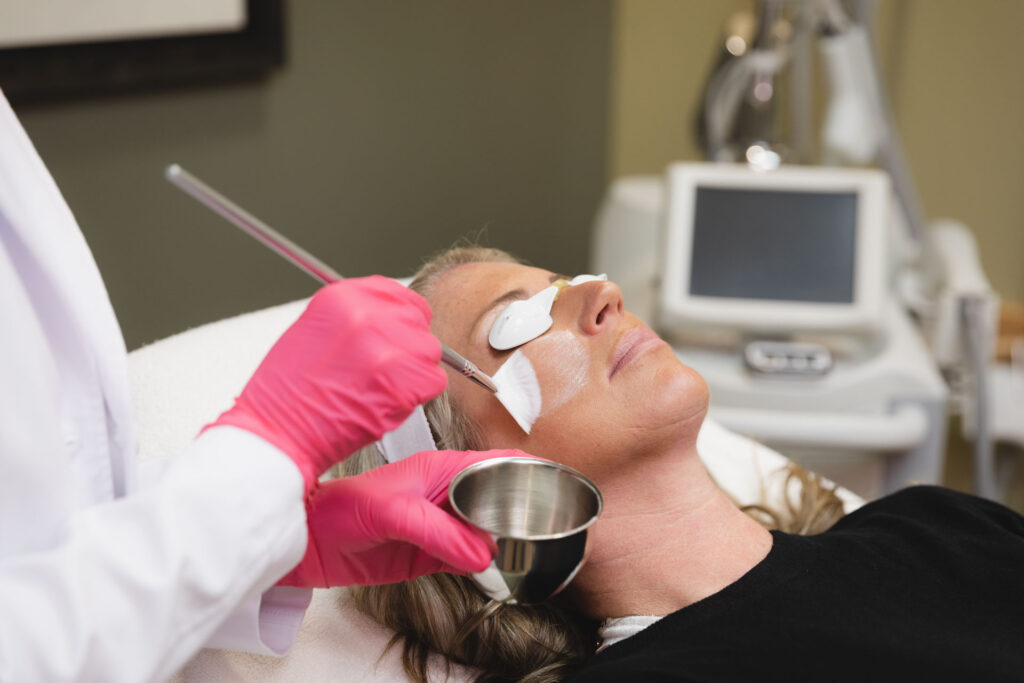 Woman lying with eyes covered as gloved professional applies chemical peel with brush.