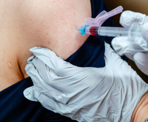 A close-up on a patient's arm as they receive hormone replacement therapy near Mountain Lakes, NJ.