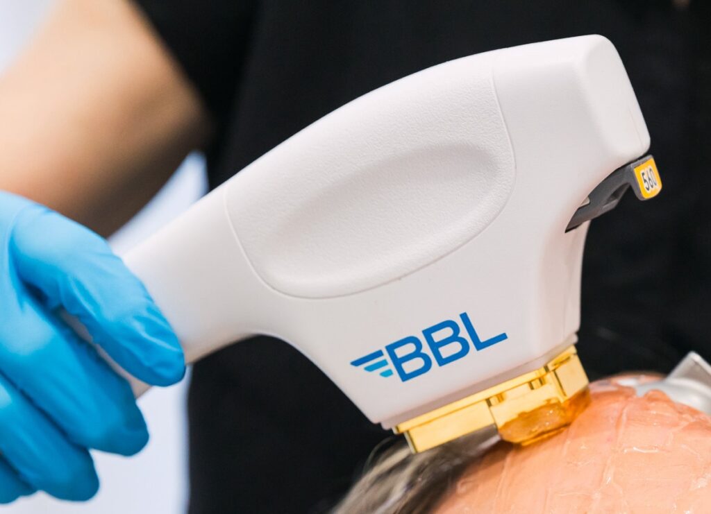 close up of BBL laser device