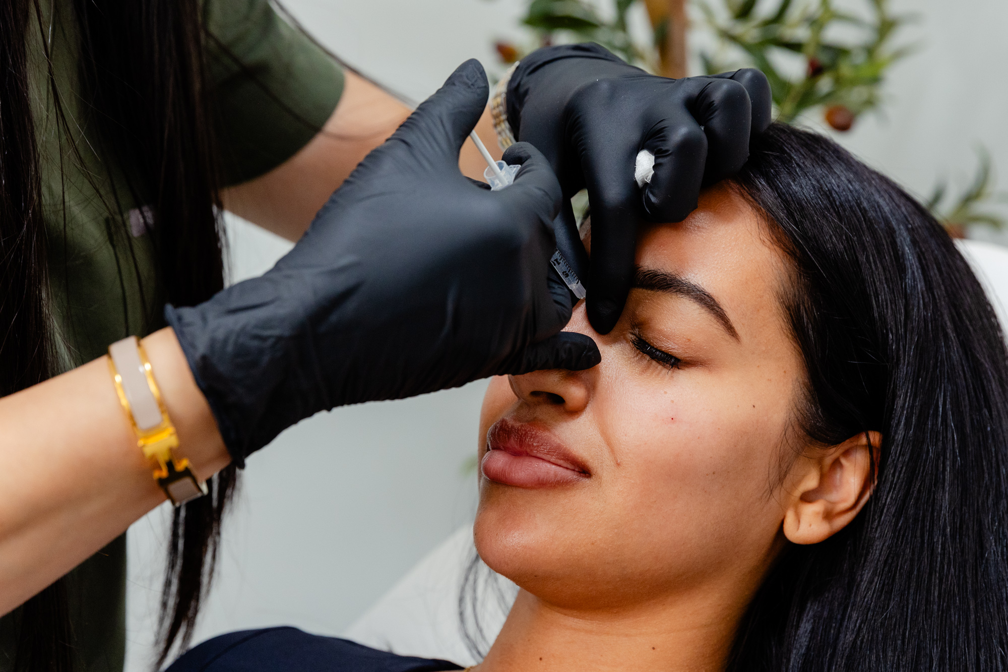 A dark-haired female patient at Exhibit Medical Aesthetics receiving injections of Botox near Madison, NJ. Her provider is injecting in between her brows to specifically target 'elevens.'