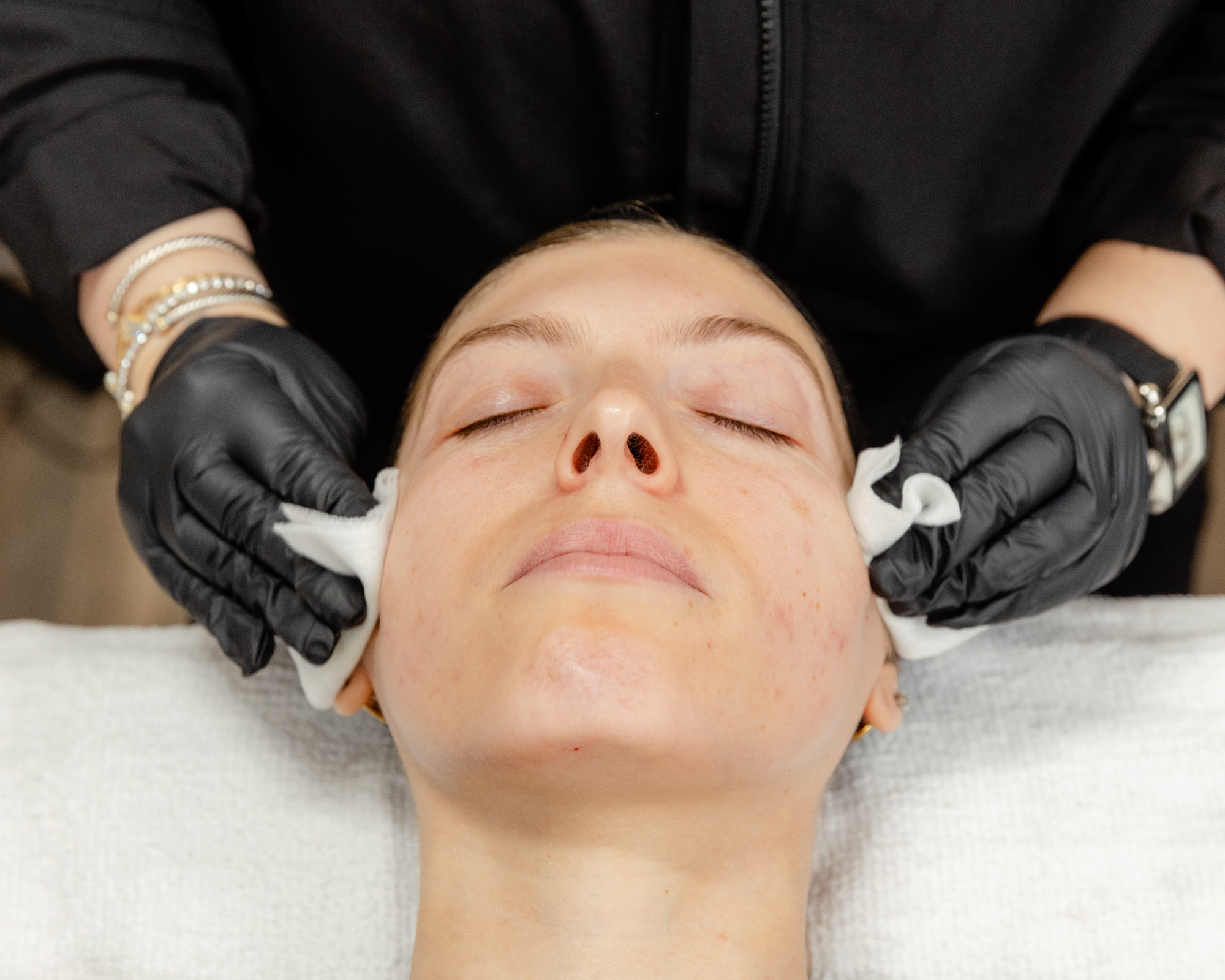 front angle of nurse drying patient's face