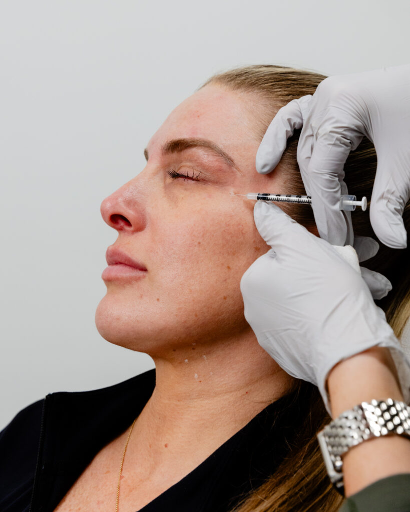 Side angle of woman receiving Dysport near eye