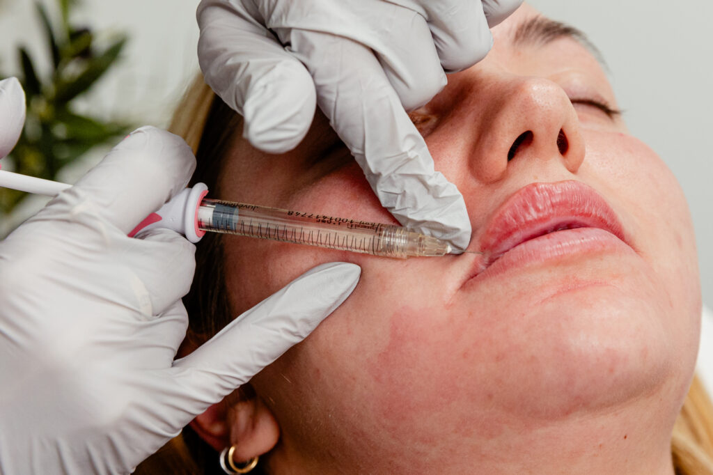 Upclose angle of patient getting lip fillers