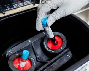 A photo of blood vials used in a hair loss treatment in Morris County, NJ