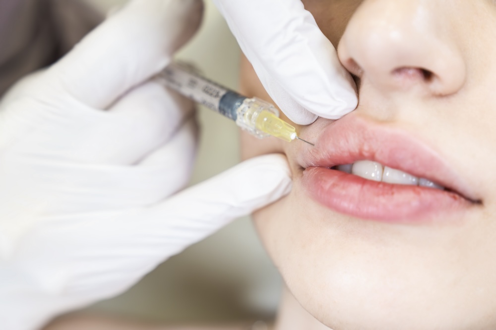 Close-up of needle injected into woman's top lip.