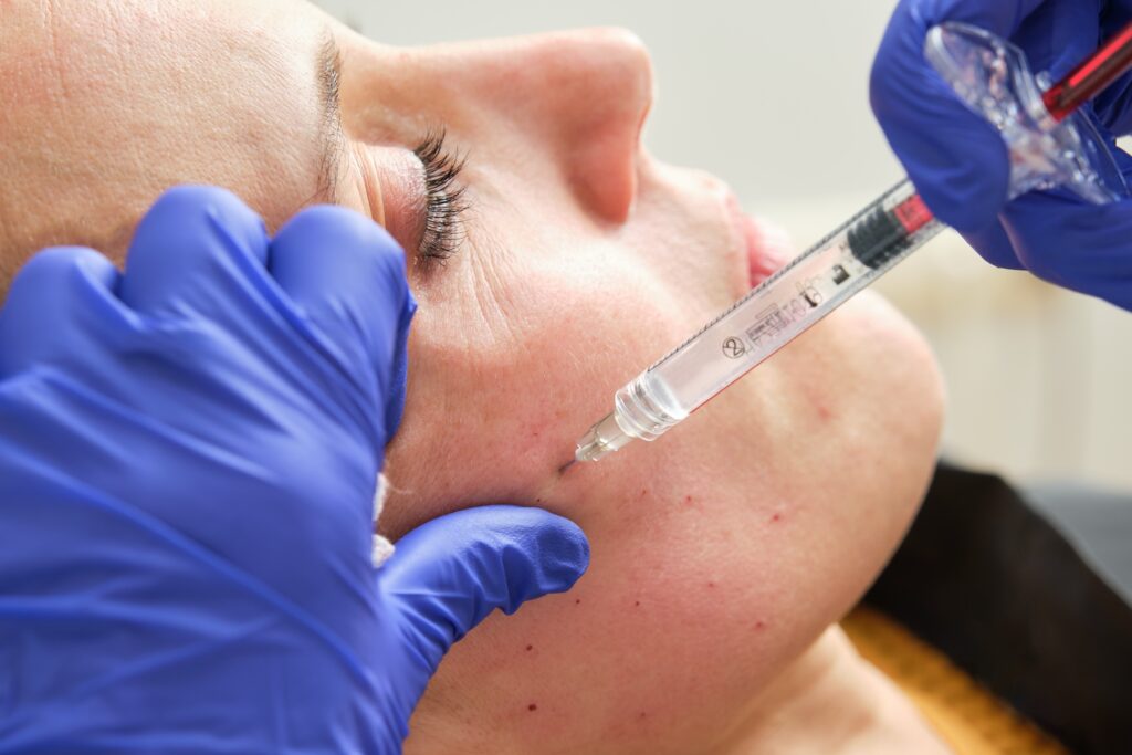 Up close photo of patient receiving cheek filler on side of face.