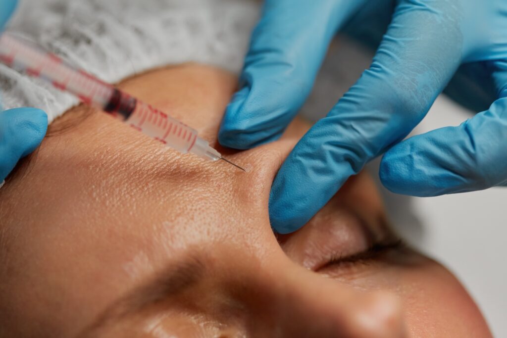 Close up shot of cosmetologist wearing gloves inserting needles into patient's upper eyebrow.