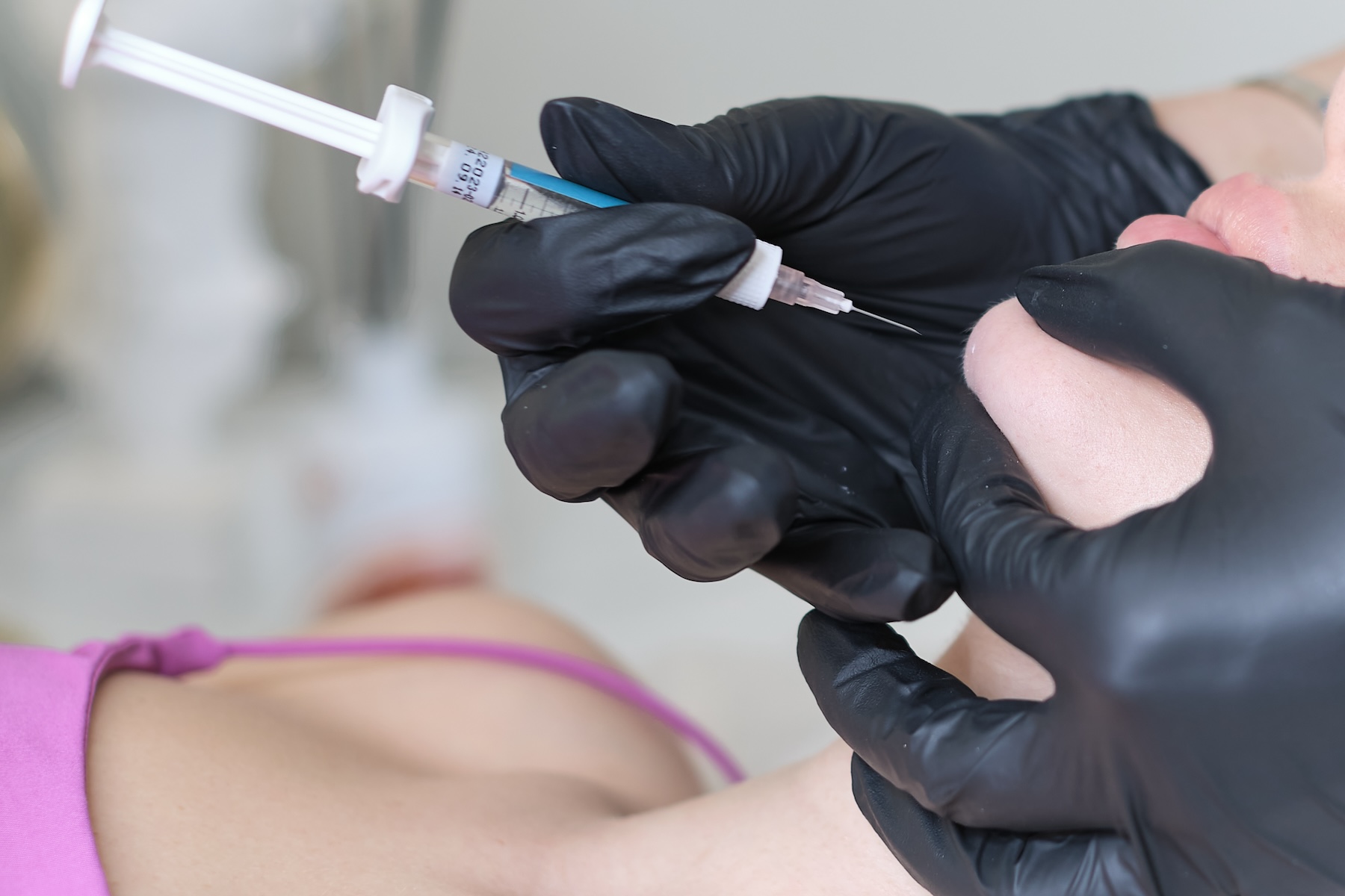 Photo of woman nurse wearing gloves inserting needle into patient's chin.