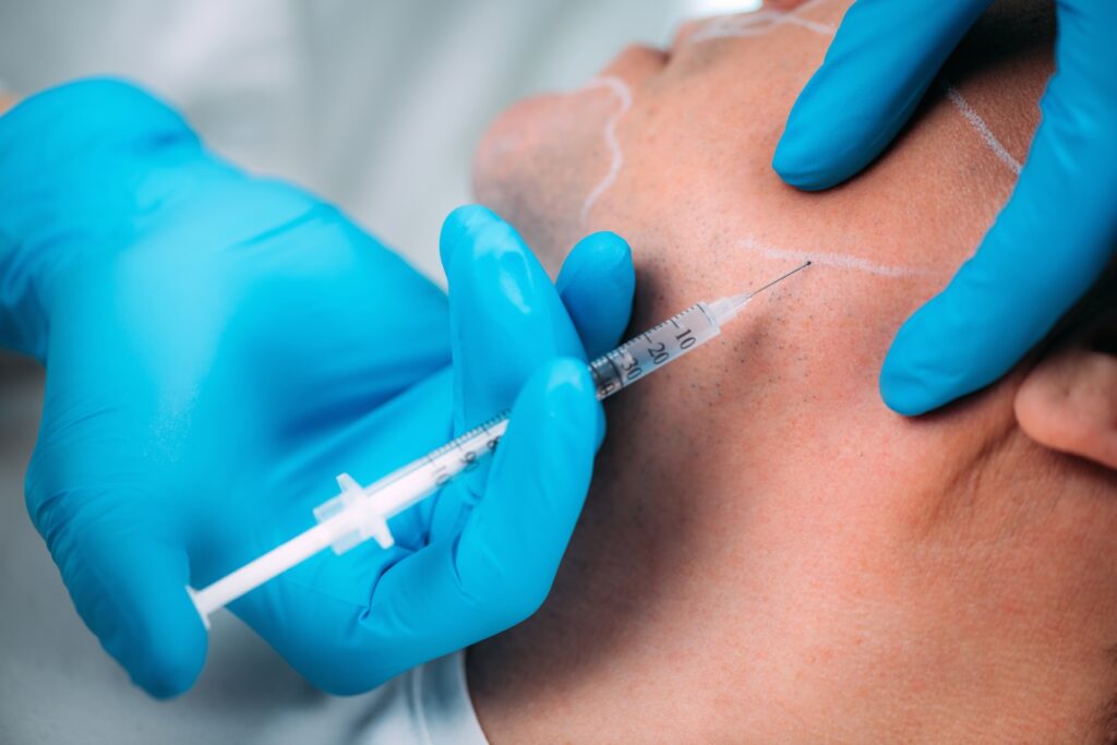 Photo of patient with lines on face and nurse inserting needle into jawline.