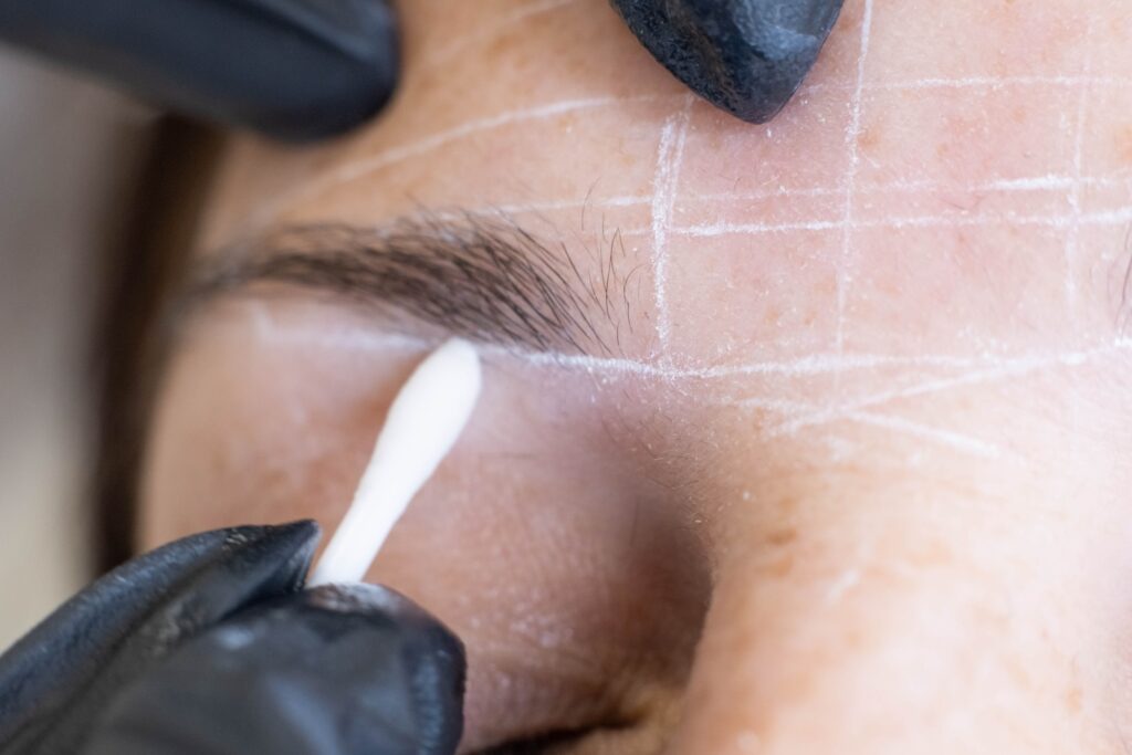 Lines on forehead for eyebrow mapping.
