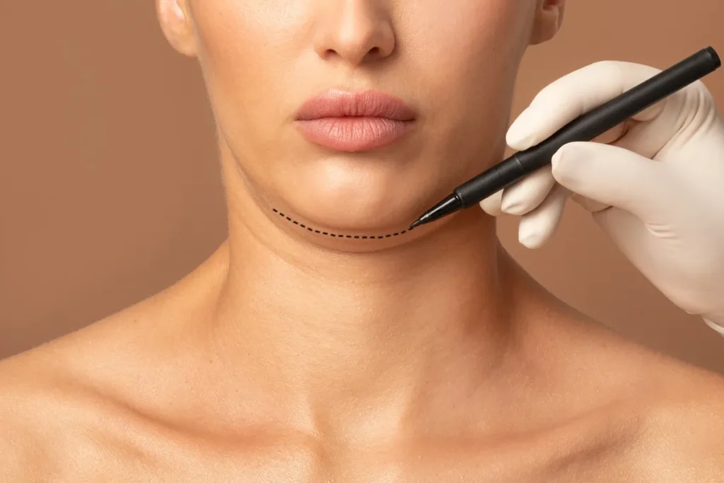 Kybella in Denville, NJ